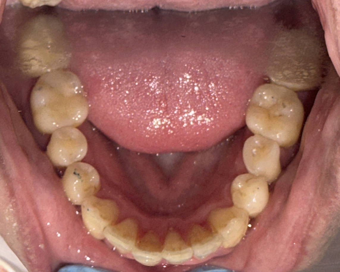 Copy of IMG 5119 - Heart of Hingham Dental Aesthetics